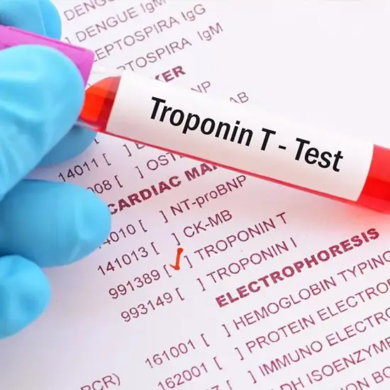 Troponin-T High Sensitive Test